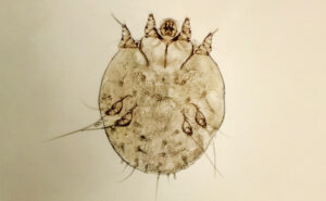 Scabies mite (Sarcoptes scabiei [var.] hominis). (Photo: Aliaksei Marozau/Shutterstock.com)