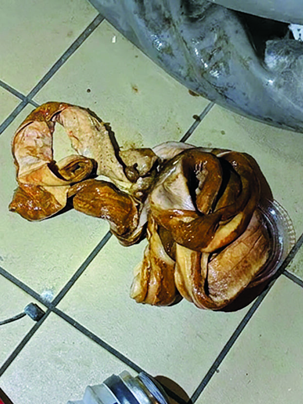 FIG. 1. This is a sugar snake biofilm removed from a commercial drain system. These rope-like accumulations of organic material are composed of sugars, grease, yeast, bacteria and debris that can serve as developmental sites for fruit flies (Drosophilidae), phorid flies (Phoridae) and drain flies (Psychodidae). (Photo: Dr. Mohammed El Damir)